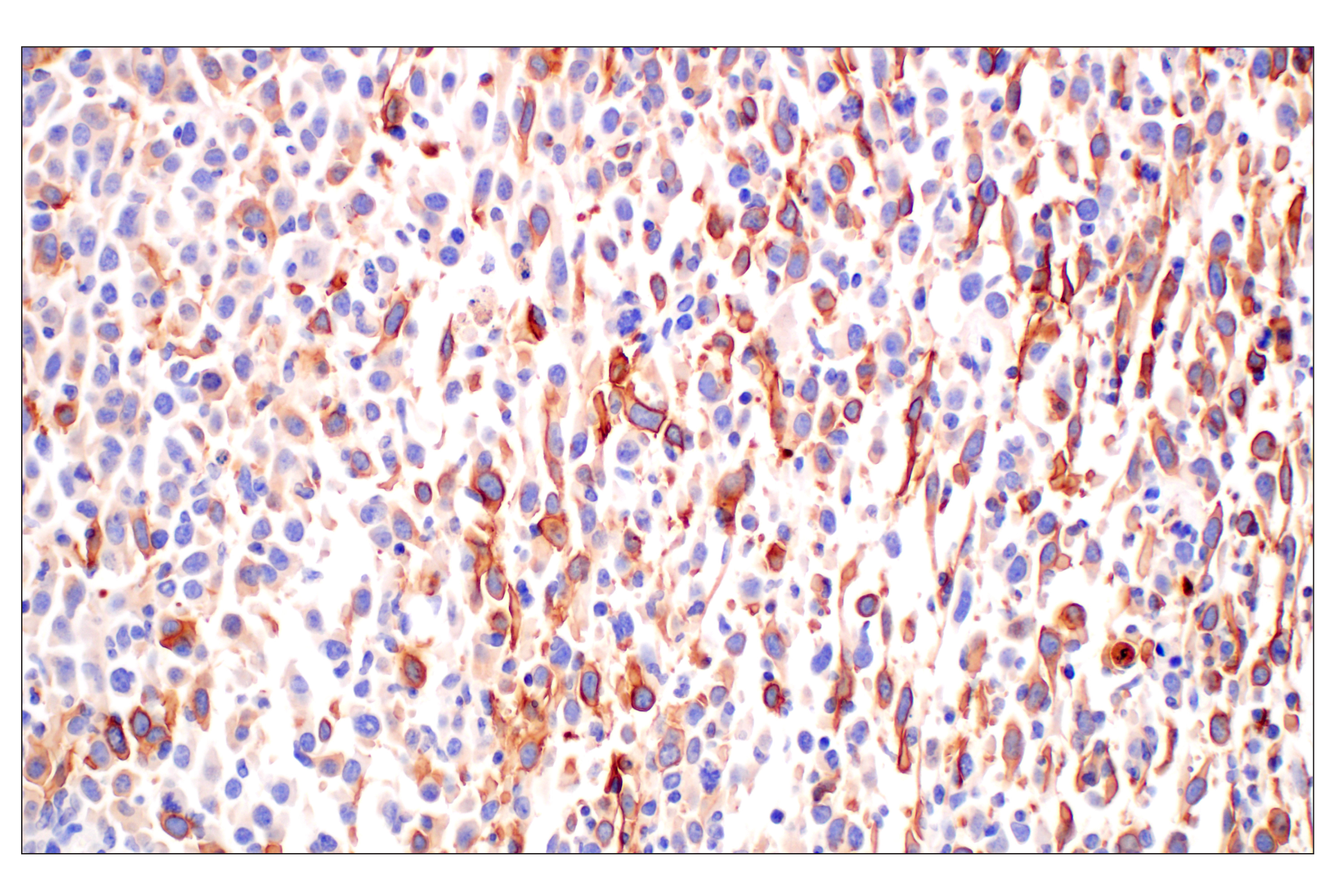 Immunohistochemistry Image 2: CD10/Neprilysin (F4P6H) Rabbit mAb (BSA and Azide Free)
