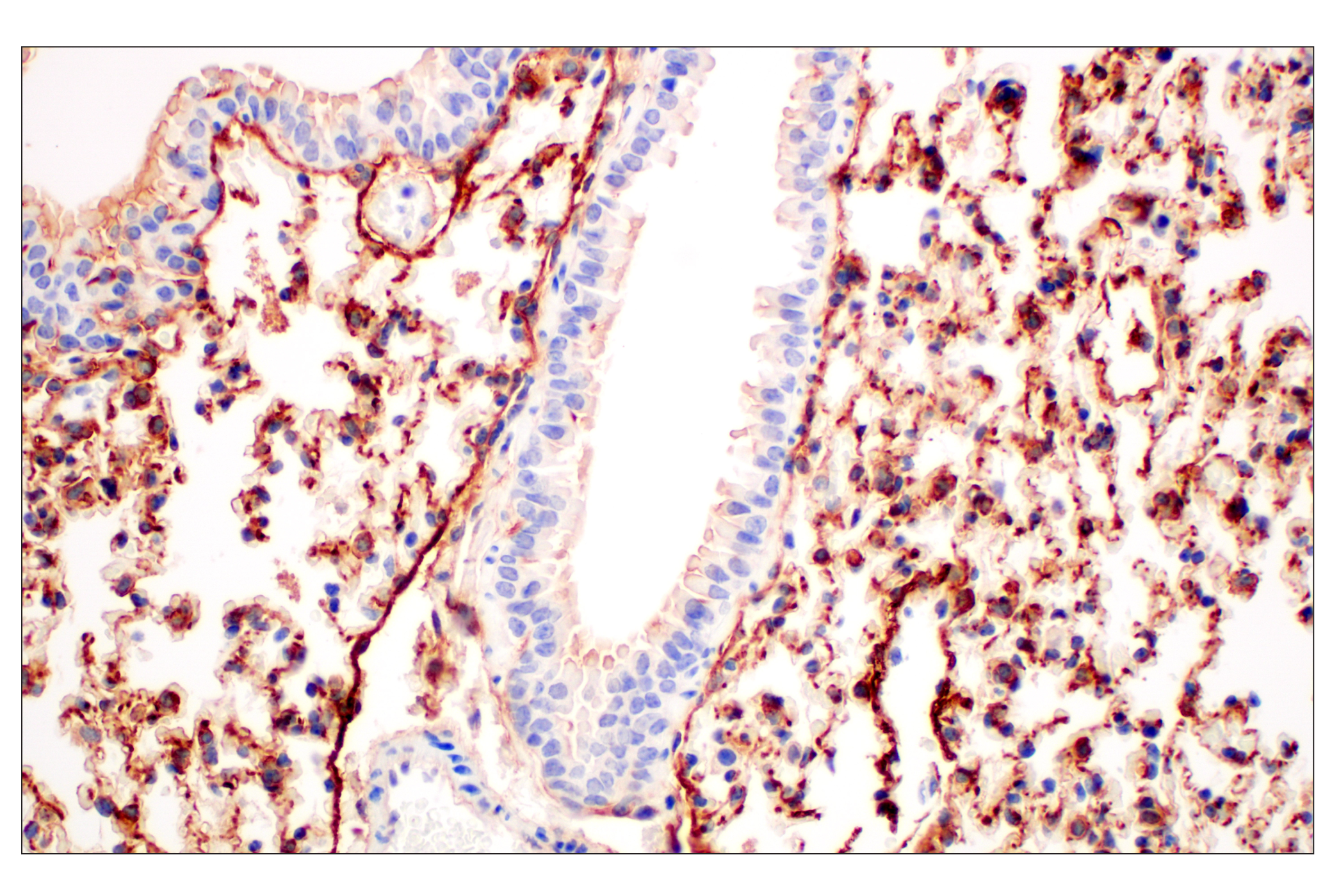 Immunohistochemistry Image 3: CD10/Neprilysin (F4P6H) Rabbit mAb (BSA and Azide Free)