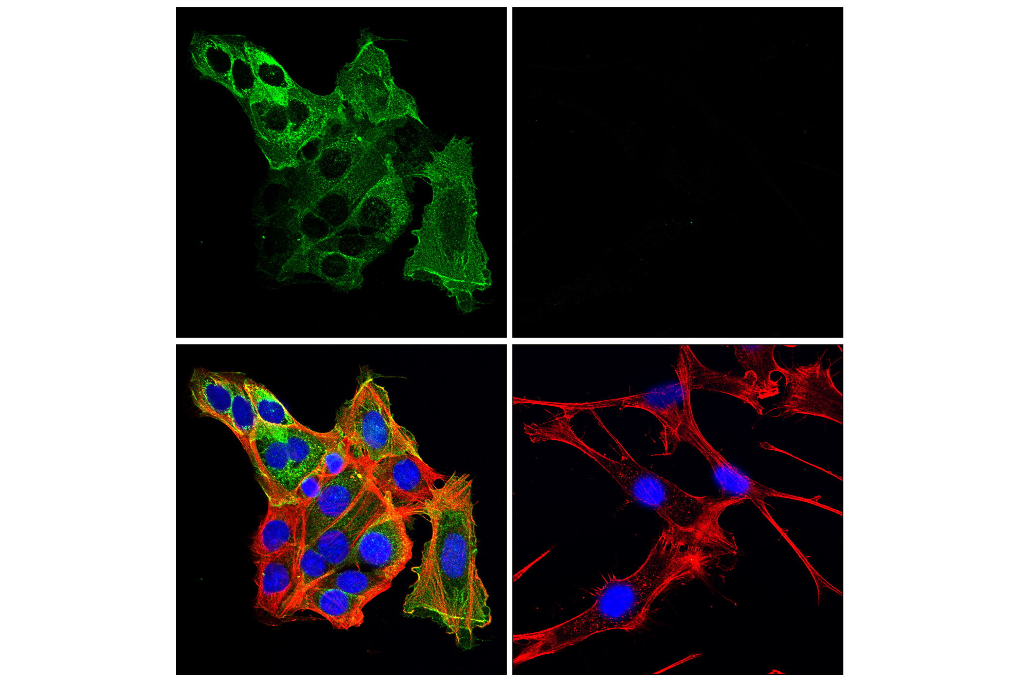 Immunofluorescence Image 3: CD10/Neprilysin (F4P6H) Rabbit mAb (BSA and Azide Free)