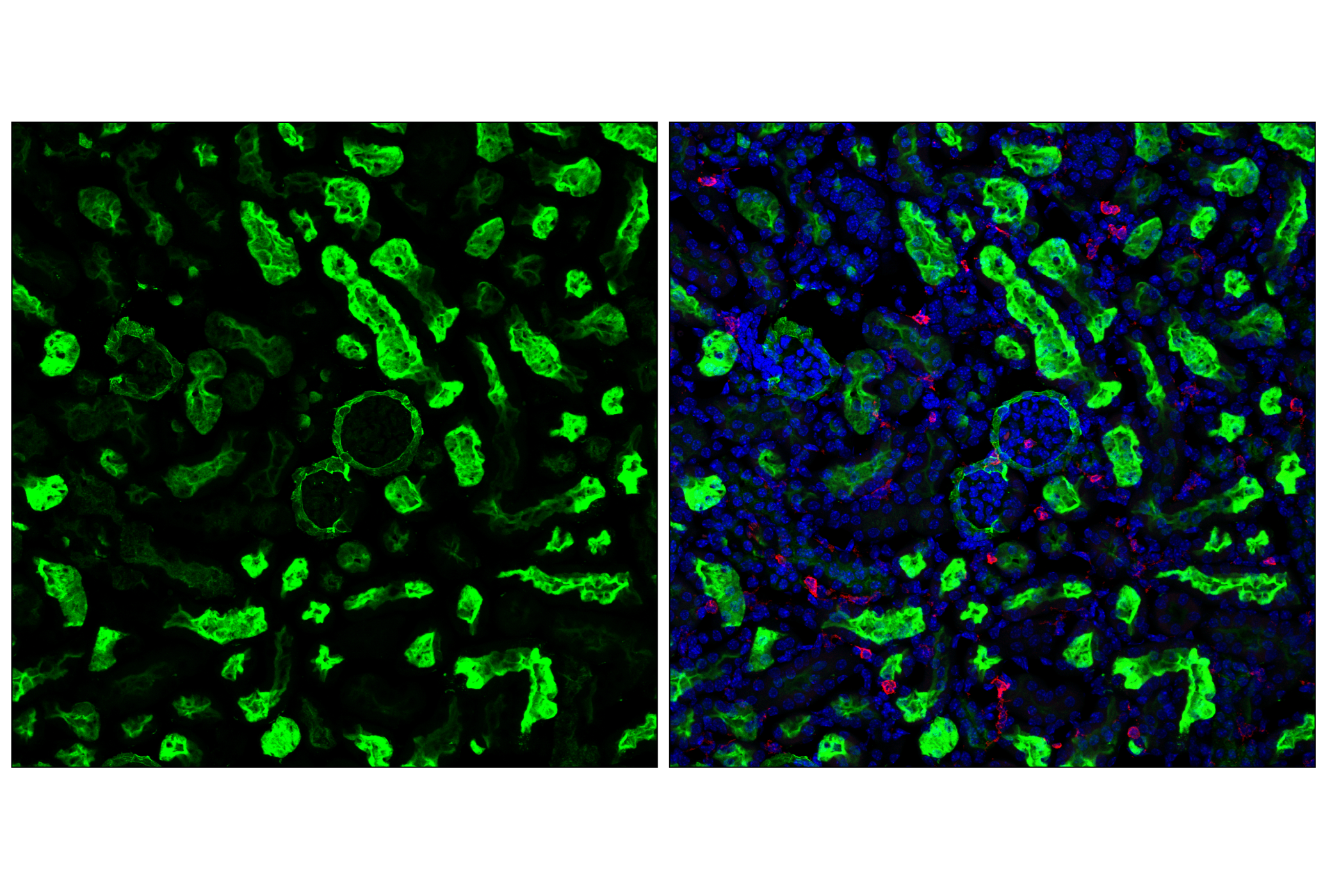 Immunofluorescence Image 1: CD10/Neprilysin (F4P6H) Rabbit mAb (BSA and Azide Free)