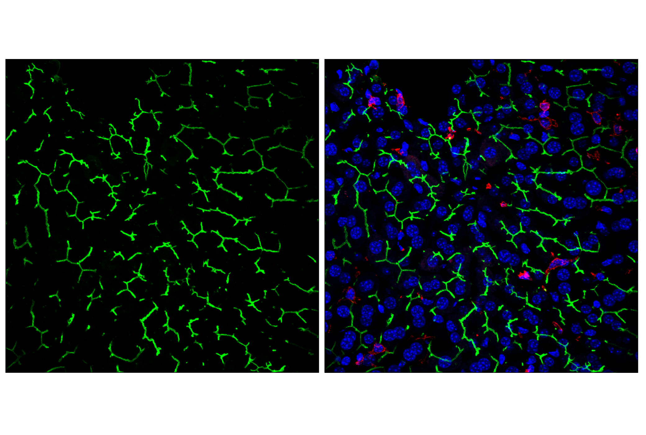 Immunofluorescence Image 2: CD10/Neprilysin (F4P6H) Rabbit mAb (BSA and Azide Free)