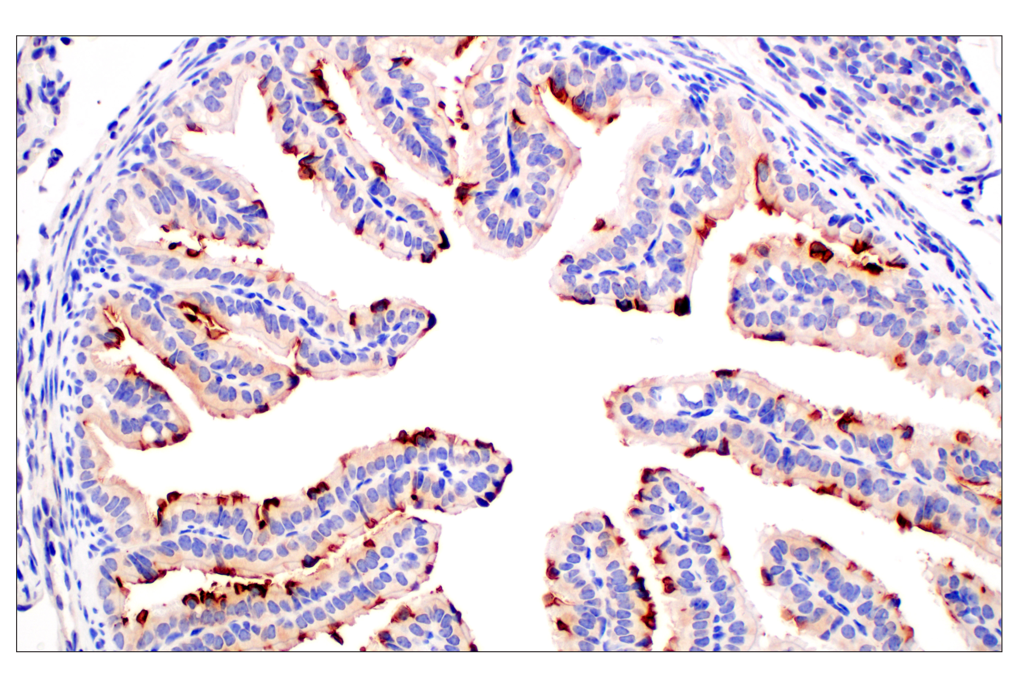 Immunohistochemistry Image 6: CD10/Neprilysin (F4P6H) Rabbit mAb (BSA and Azide Free)