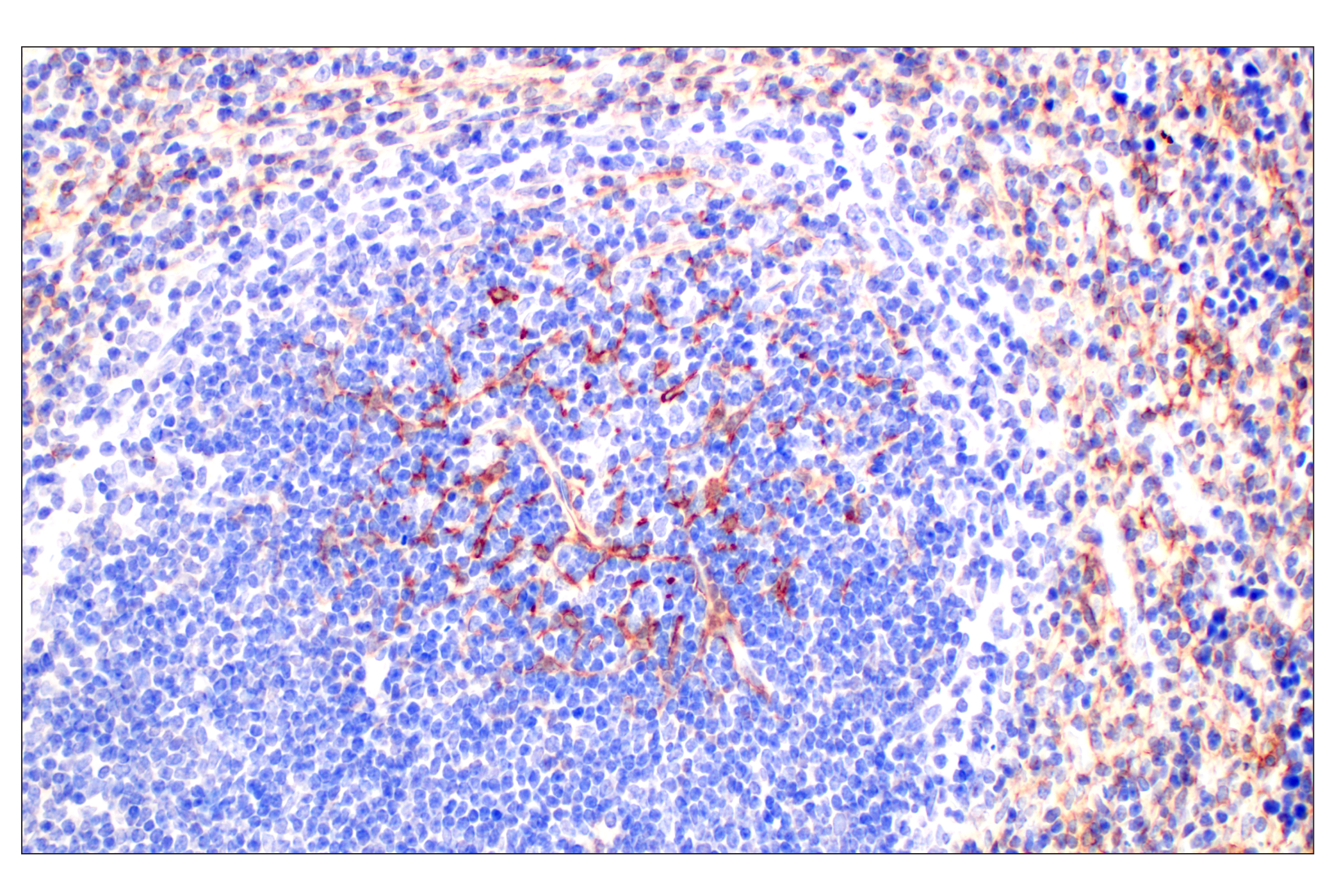 Immunohistochemistry Image 5: CD10/Neprilysin (F4P6H) Rabbit mAb (BSA and Azide Free)