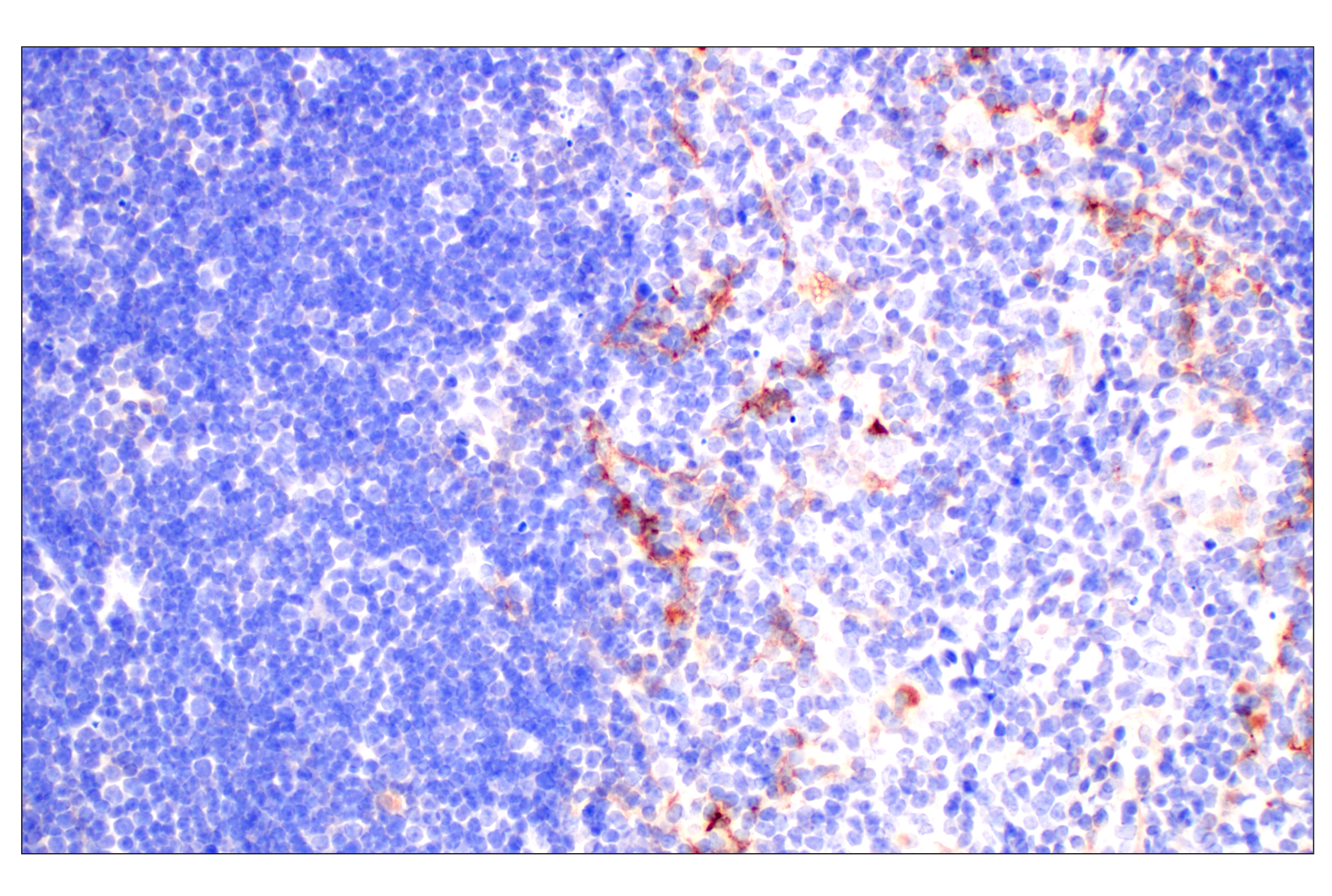 Immunohistochemistry Image 7: CD10/Neprilysin (F4P6H) Rabbit mAb (BSA and Azide Free)