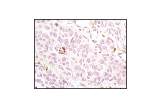 Immunohistochemistry Image 2: Notch1 (D1E11) XP® Rabbit mAb (BSA and Azide Free)