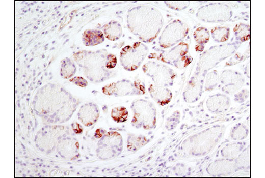 Immunohistochemistry Image 4: Notch1 (D1E11) XP® Rabbit mAb (BSA and Azide Free)