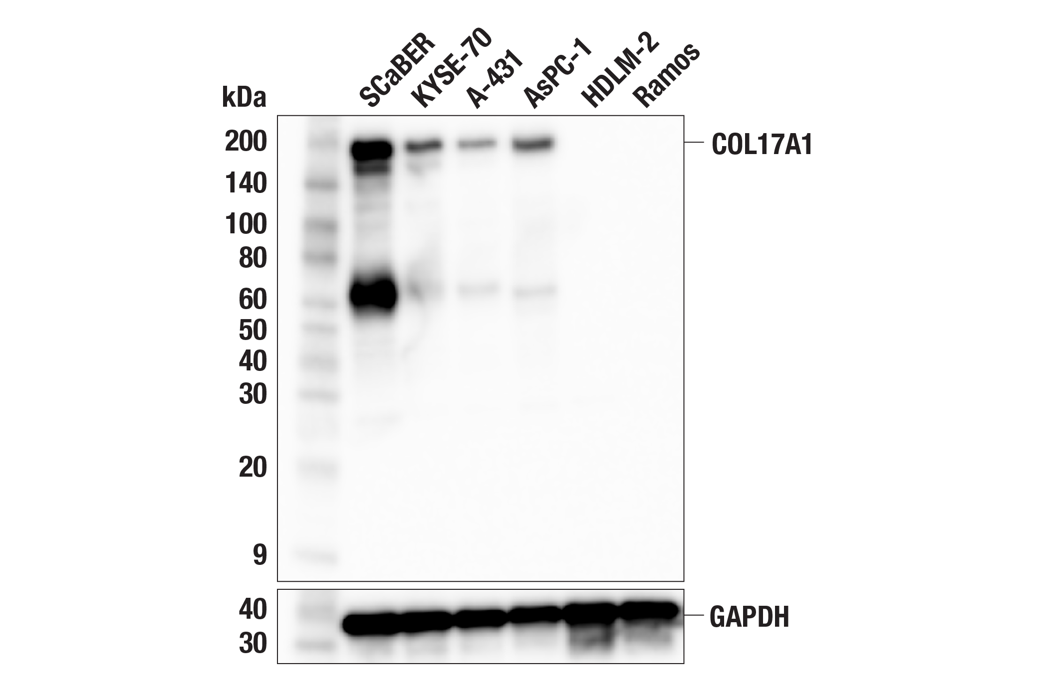 Western Blotting Image 2: COL17A1 (F5U1Z) Rabbit Monoclonal Antibody