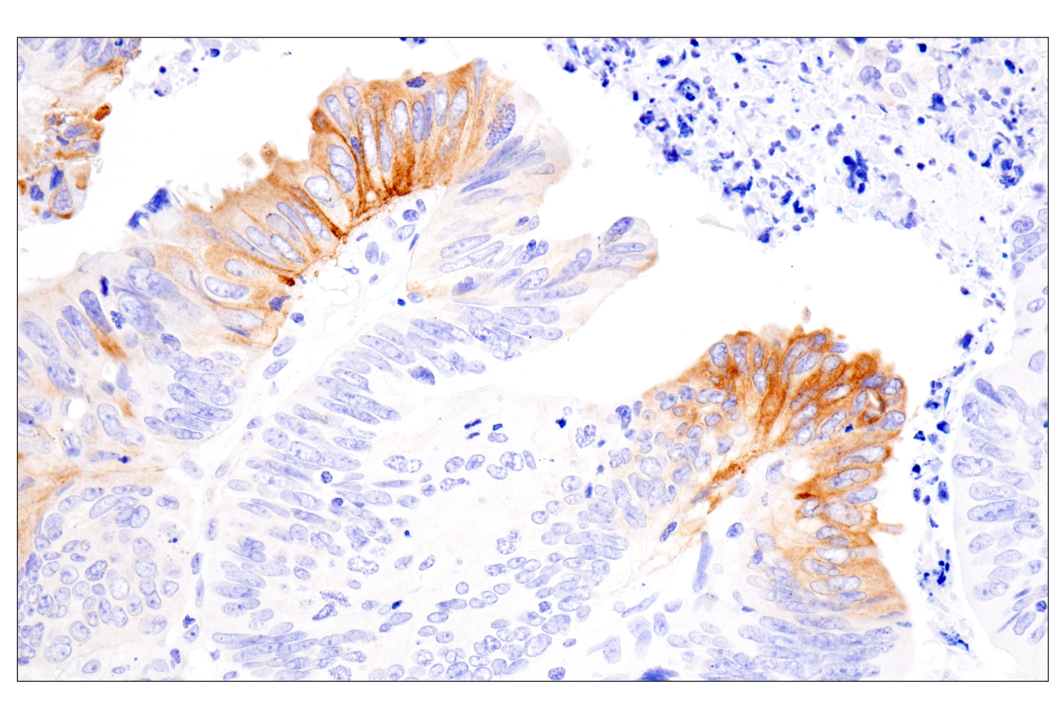 Immunohistochemistry Image 2: COL17A1 (F5U1Z) Rabbit Monoclonal Antibody