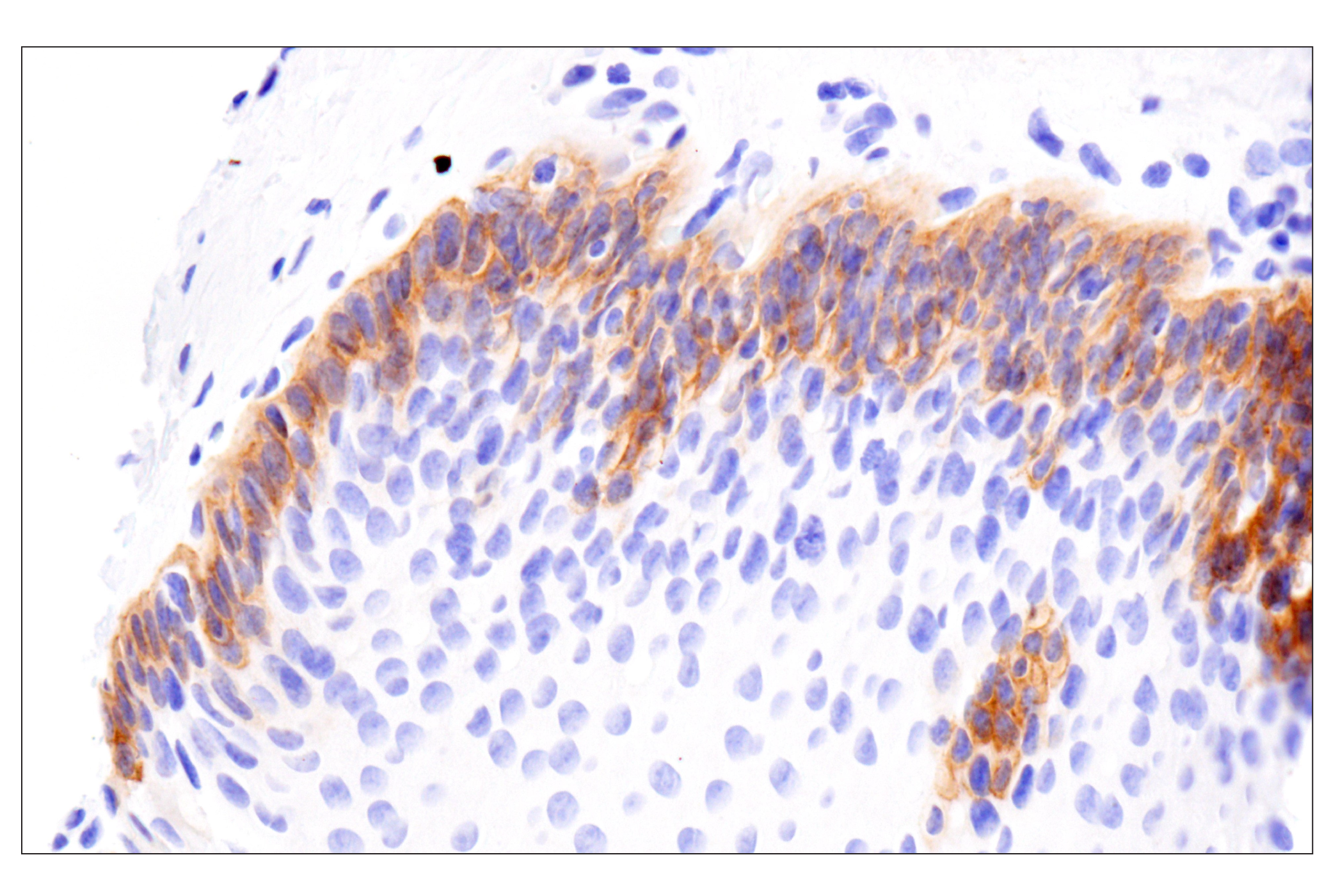Immunohistochemistry Image 8: COL17A1 (F5U1Z) Rabbit Monoclonal Antibody