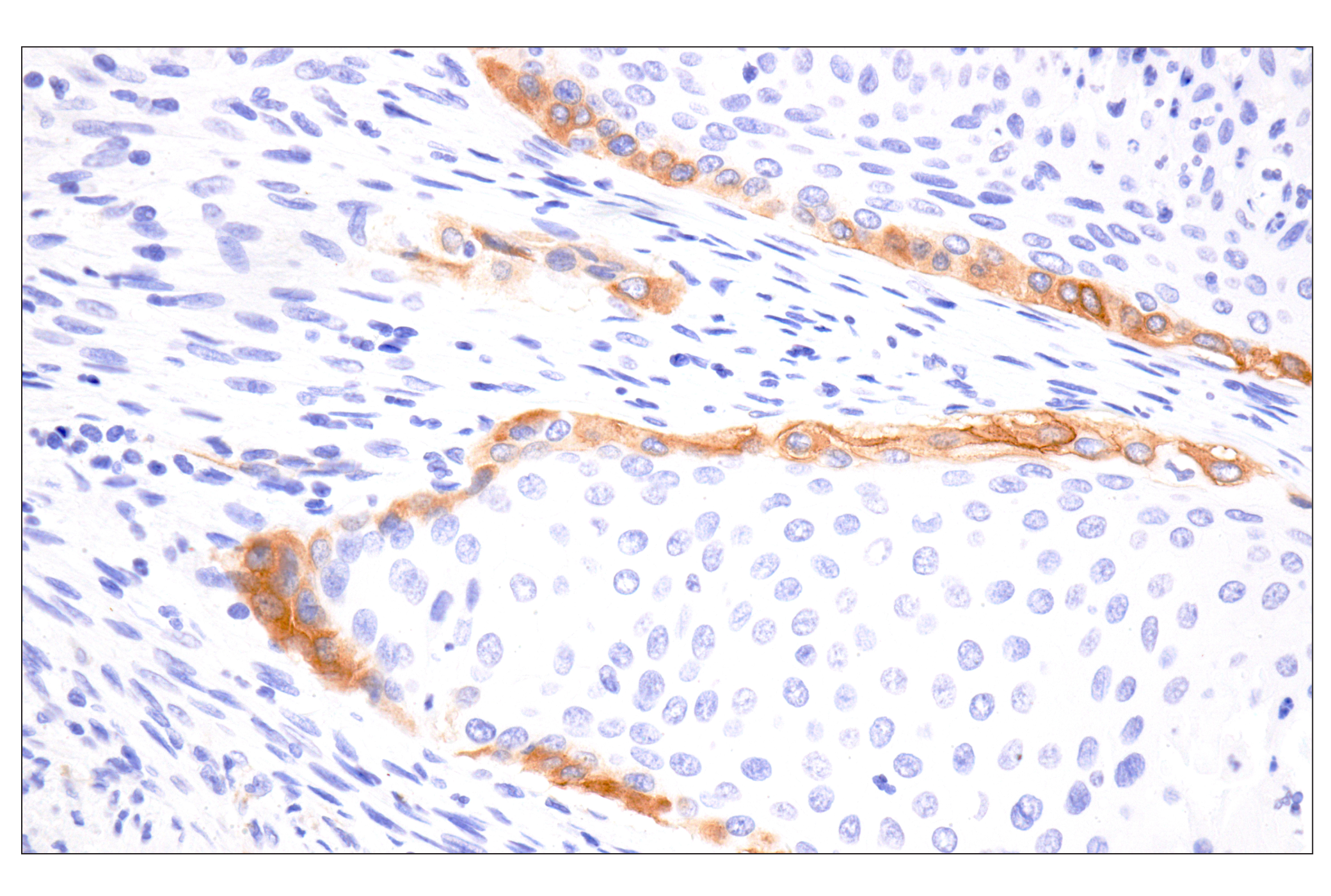 Immunohistochemistry Image 4: COL17A1 (F5U1Z) Rabbit Monoclonal Antibody