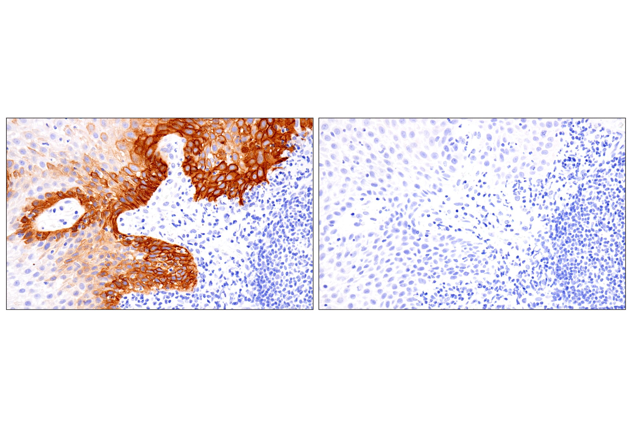 Immunohistochemistry Image 9: COL17A1 (F5U1Z) Rabbit Monoclonal Antibody