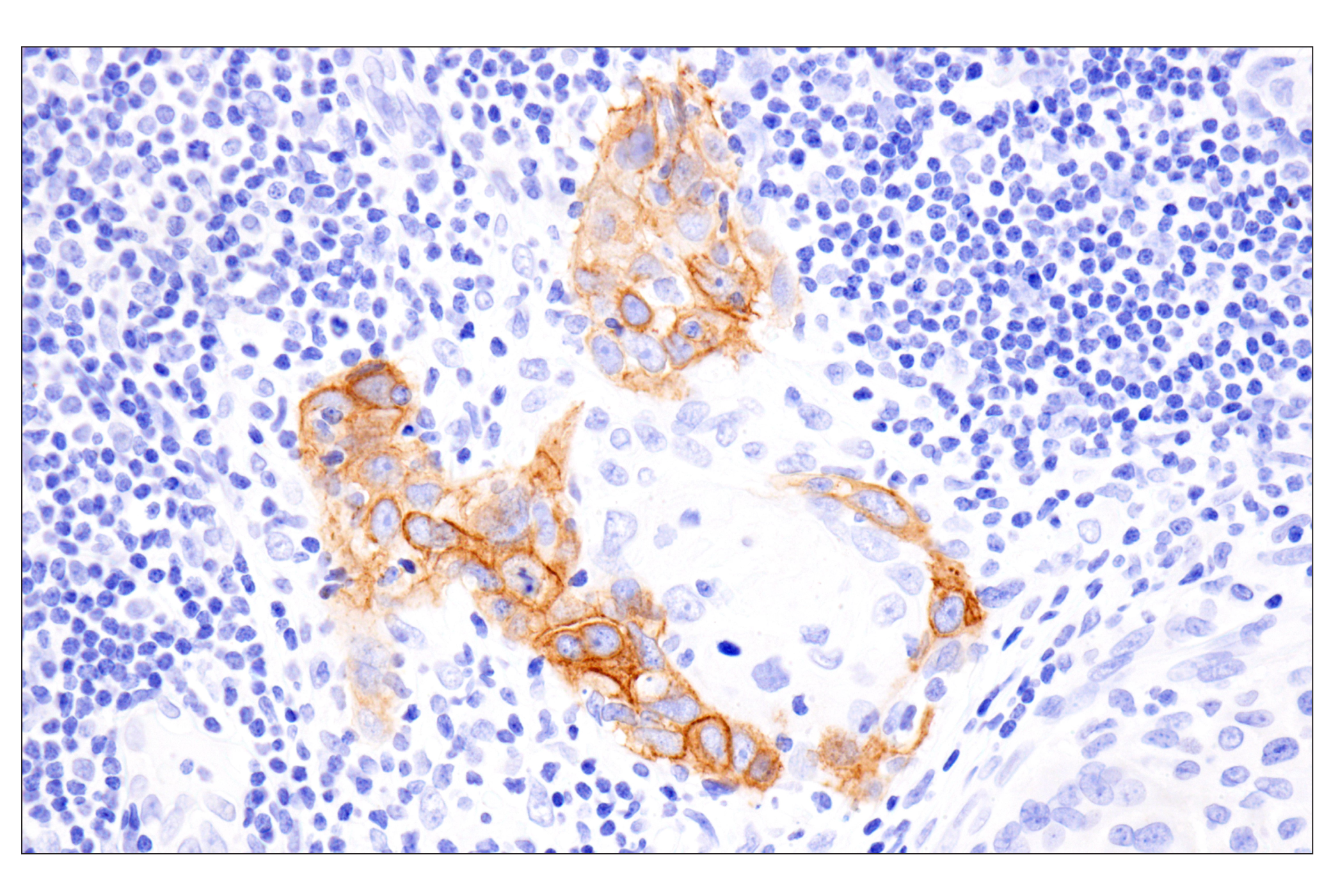 Immunohistochemistry Image 5: COL17A1 (F5U1Z) Rabbit Monoclonal Antibody