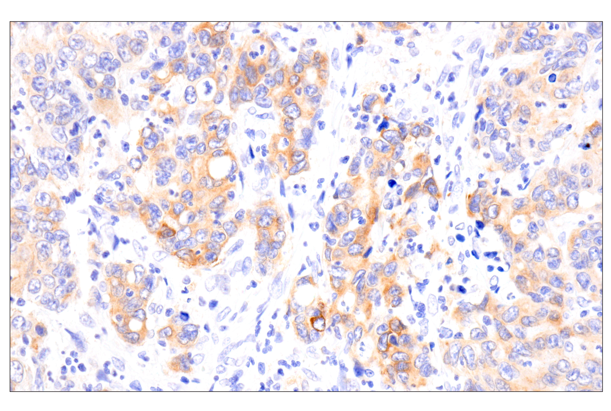 Immunohistochemistry Image 6: COL17A1 (F5U1Z) Rabbit Monoclonal Antibody