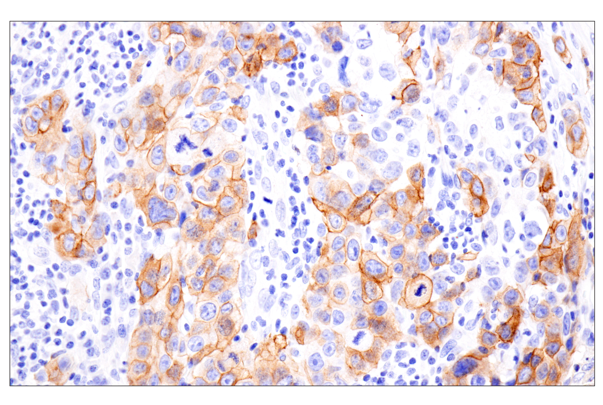 Immunohistochemistry Image 1: COL17A1 (F5U1Z) Rabbit Monoclonal Antibody