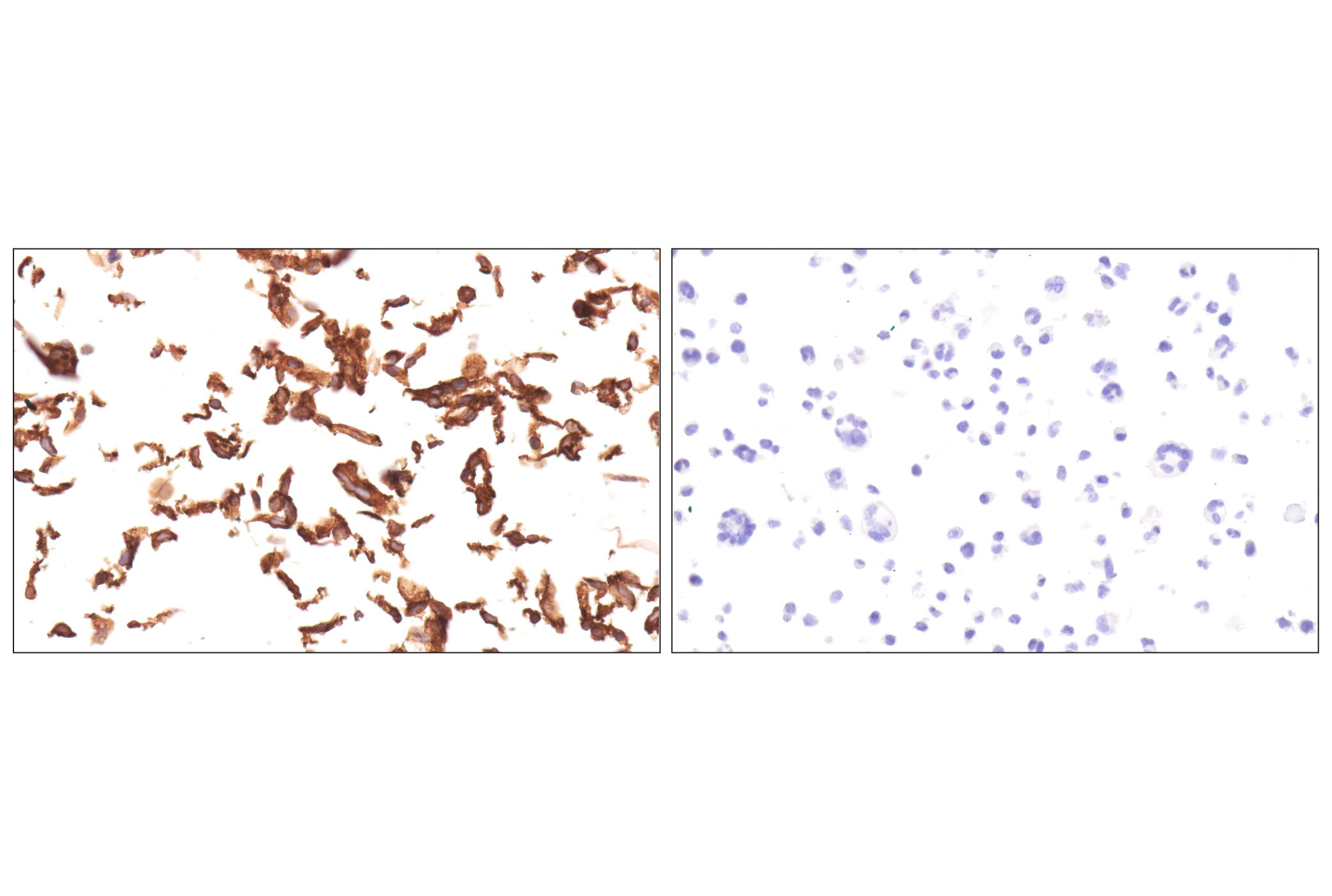 Immunohistochemistry Image 10: COL17A1 (F5U1Z) Rabbit Monoclonal Antibody