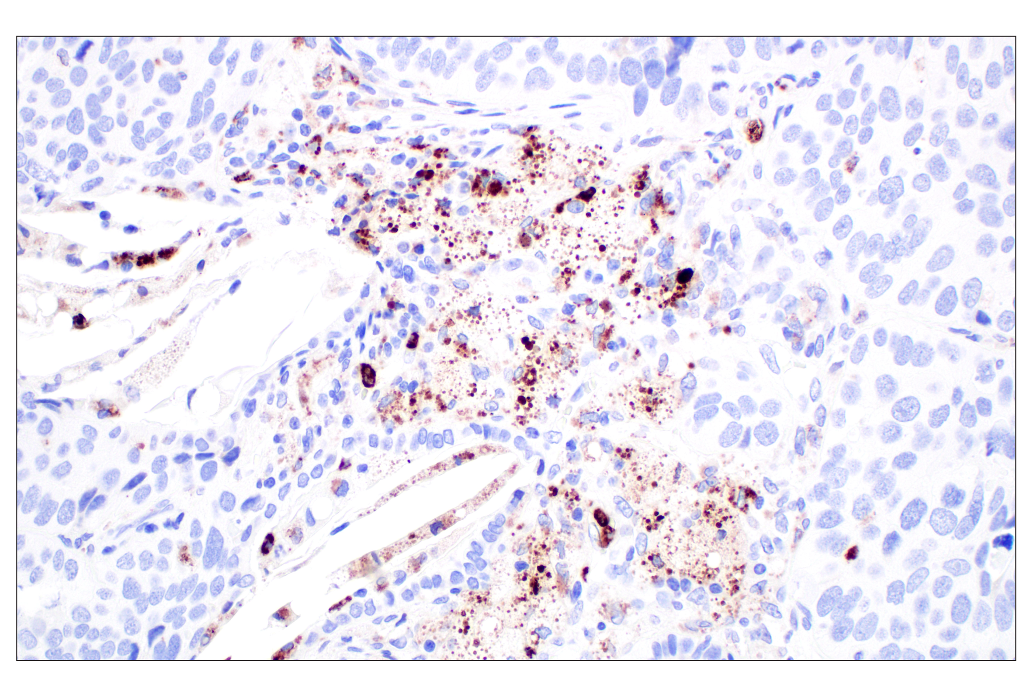 Immunohistochemistry Image 1: Lysozyme C (E9W6E) Rabbit mAb