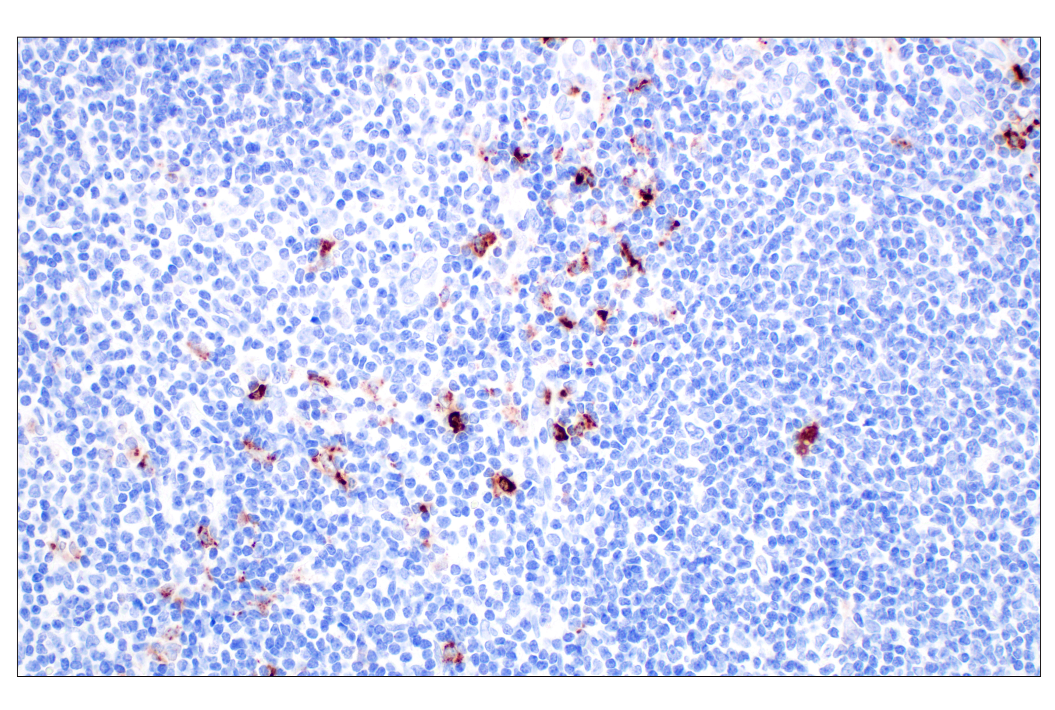 Immunohistochemistry Image 3: Lysozyme C (E9W6E) Rabbit mAb