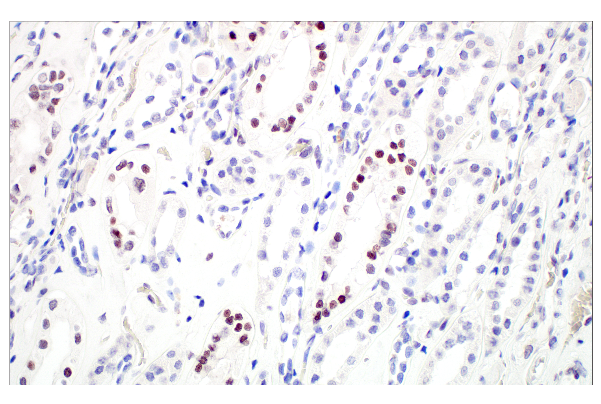 Immunohistochemistry Image 6: GATA-2 (E8B5C) Rabbit mAb (BSA and Azide Free)