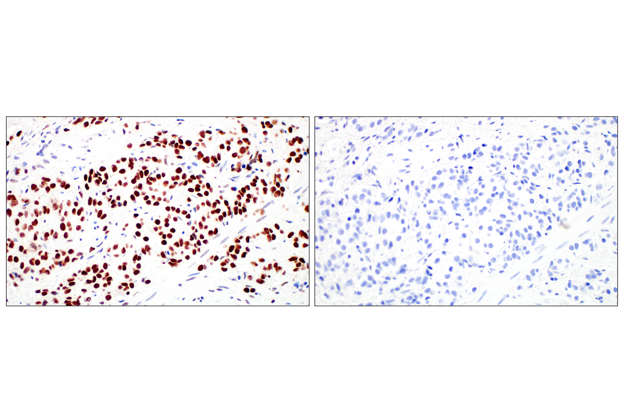 Immunohistochemistry Image 7: GATA-2 (E8B5C) Rabbit mAb (BSA and Azide Free)