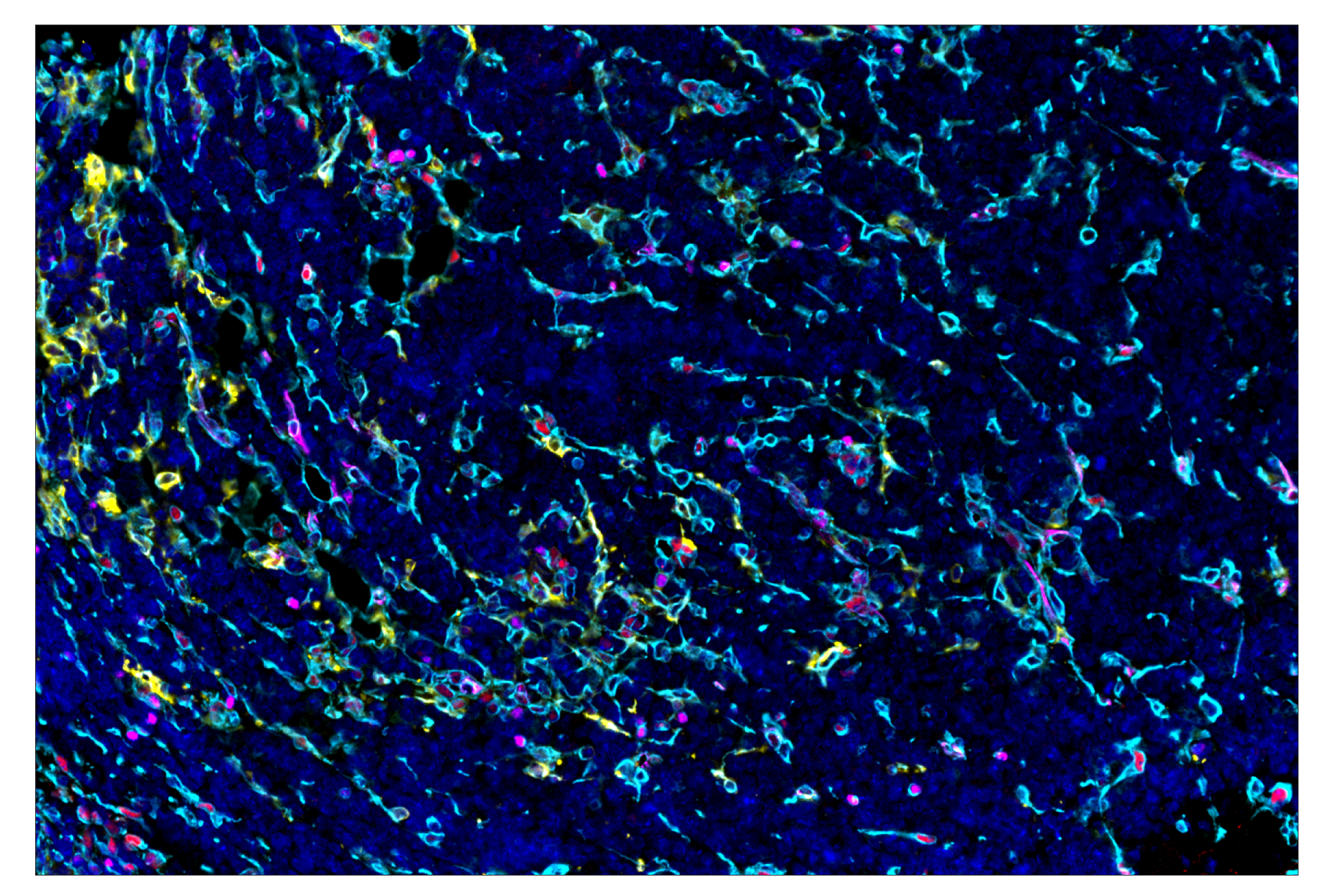 Immunohistochemistry Image 10: Phospho-SLP-76 (Ser376) (E3G9U) & CO-0018-594 SignalStar™ Oligo-Antibody Pair