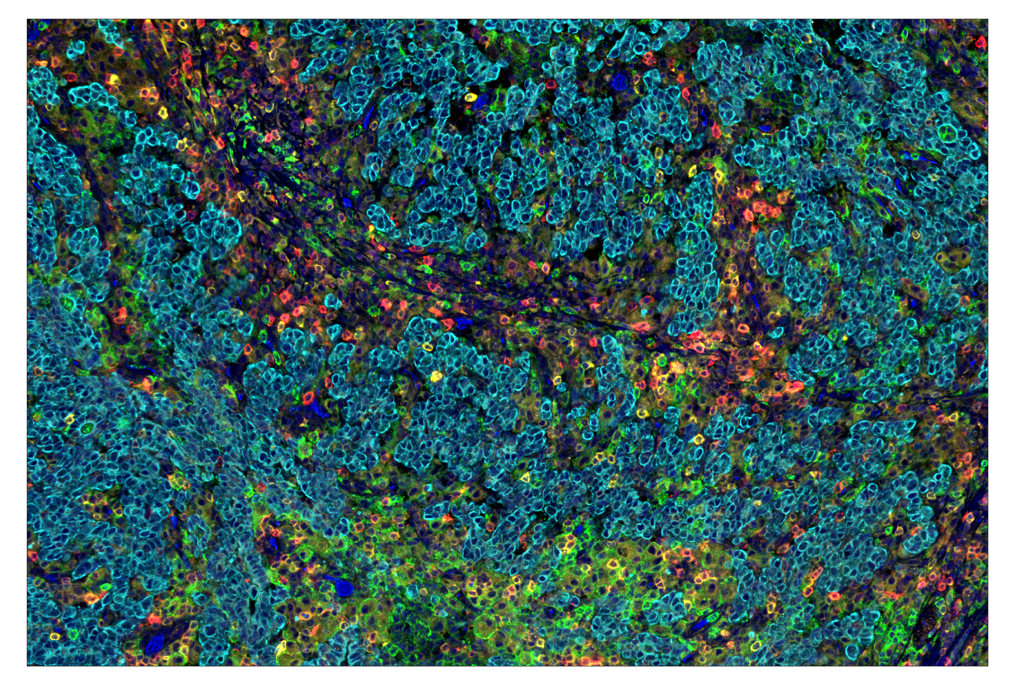 Immunohistochemistry Image 9: Phospho-SLP-76 (Ser376) (E3G9U) & CO-0018-750 SignalStar™ Oligo-Antibody Pair
