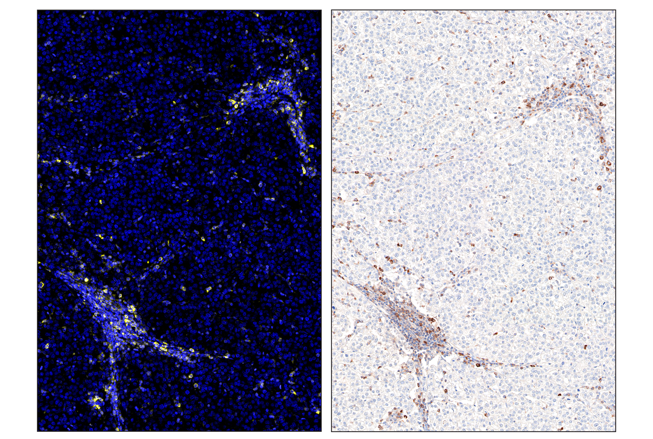 Immunohistochemistry Image 6: Phospho-SLP-76 (Ser376) (E3G9U) & CO-0018-594 SignalStar™ Oligo-Antibody Pair