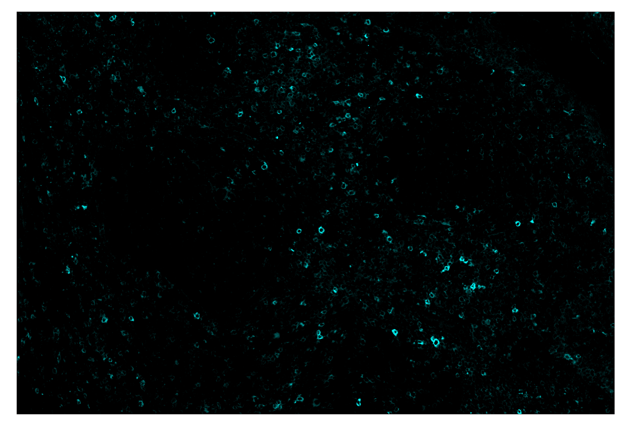 Immunohistochemistry Image 5: Phospho-SLP-76 (Ser376) (E3G9U) & CO-0018-488 SignalStar™ Oligo-Antibody Pair