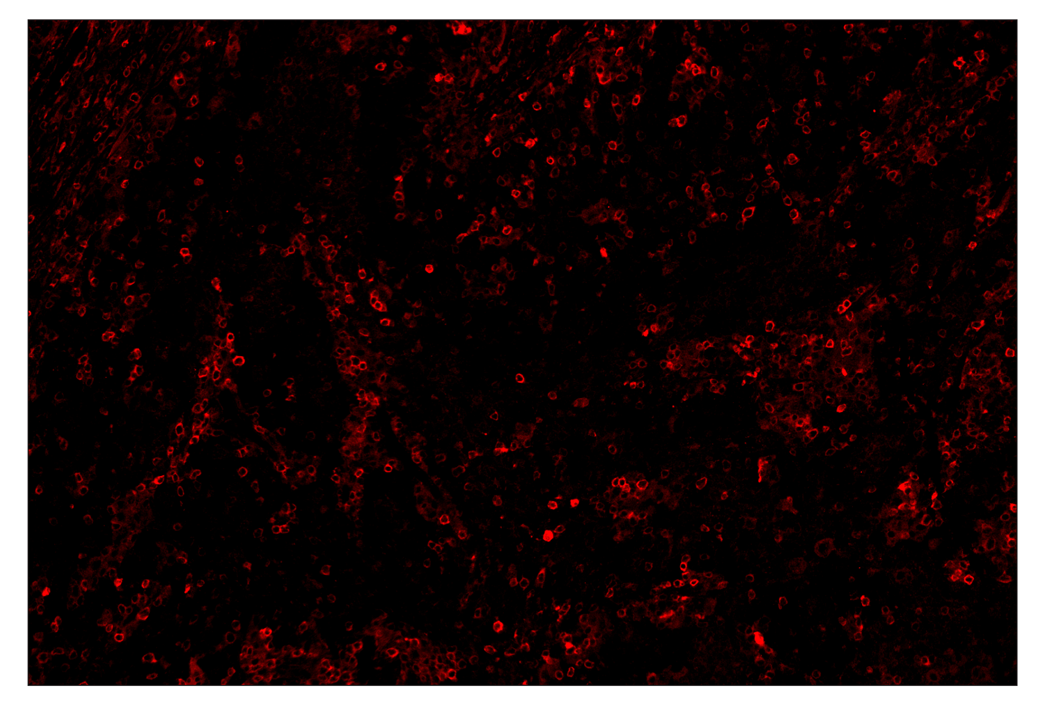 Immunohistochemistry Image 4: Phospho-SLP-76 (Ser376) (E3G9U) & CO-0018-750 SignalStar™ Oligo-Antibody Pair