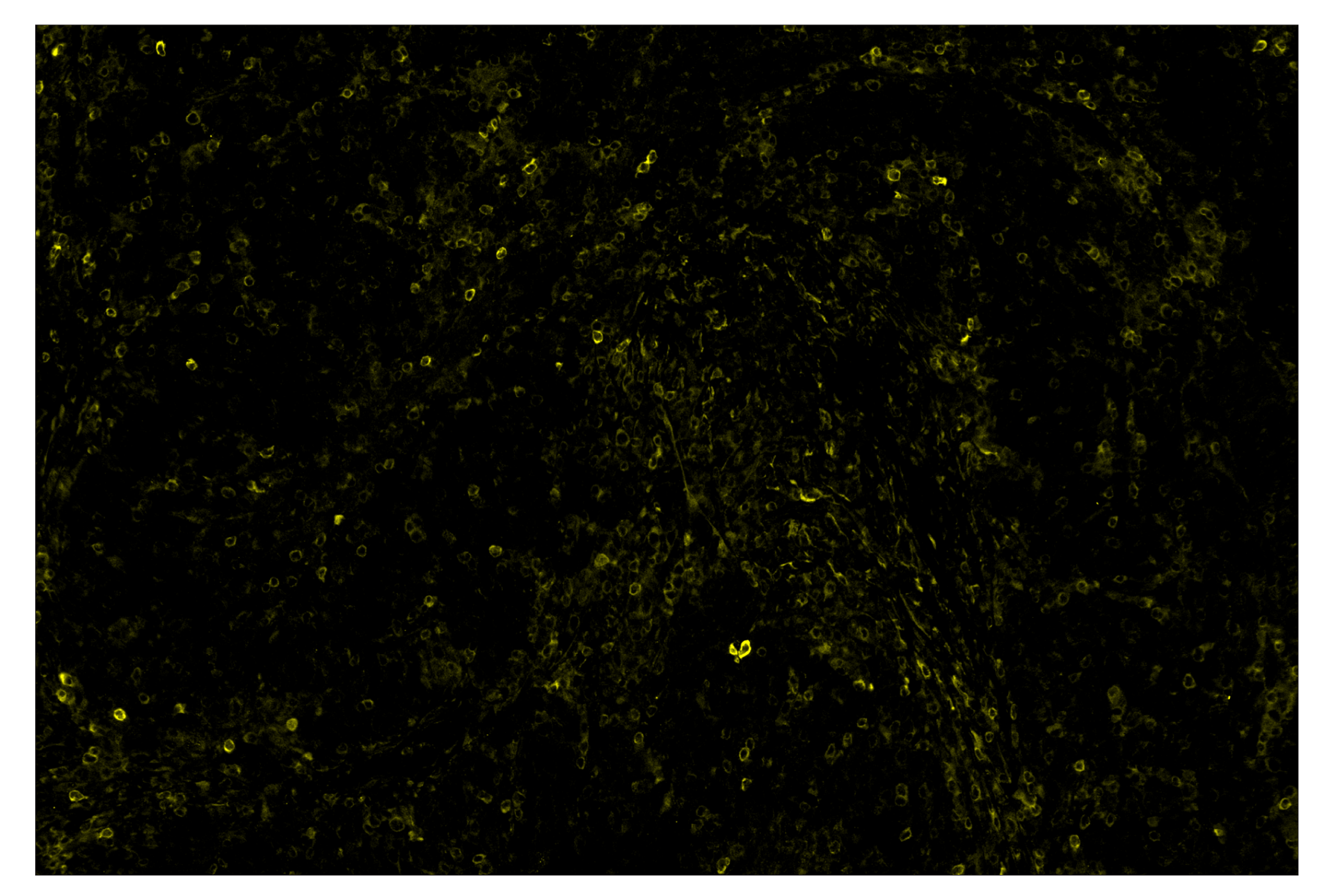 Immunohistochemistry Image 3: Phospho-SLP-76 (Ser376) (E3G9U) & CO-0018-488 SignalStar™ Oligo-Antibody Pair
