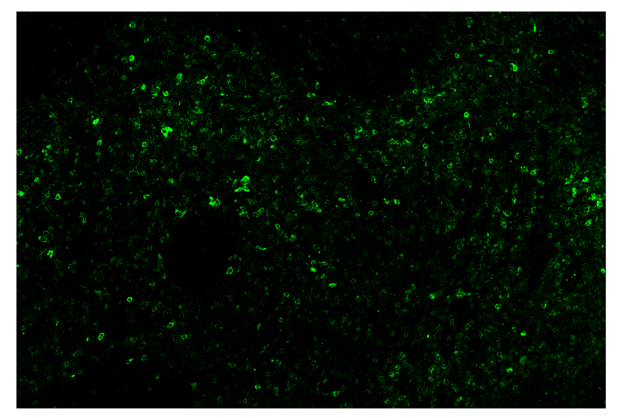 Immunohistochemistry Image 2: Phospho-SLP-76 (Ser376) (E3G9U) & CO-0018-750 SignalStar™ Oligo-Antibody Pair