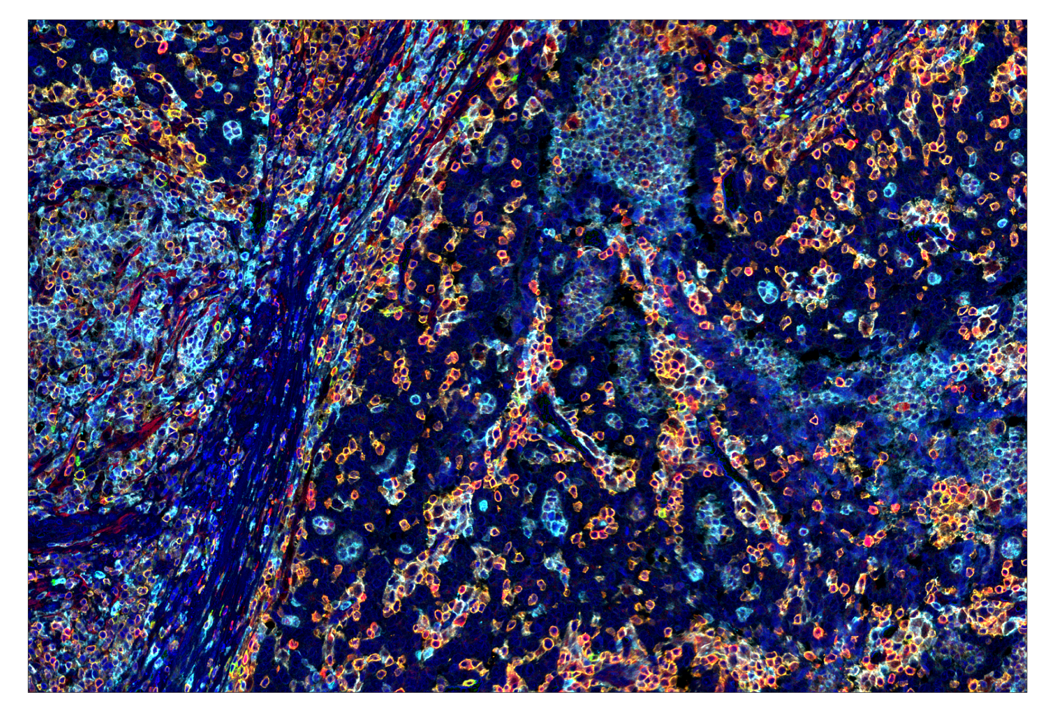 Immunohistochemistry Image 1: Phospho-SLP-76 (Ser376) (E3G9U) & CO-0018-488 SignalStar™ Oligo-Antibody Pair