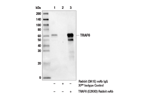 Immunoprecipitation Image 1: TRAF6 (E2K9D) Rabbit mAb