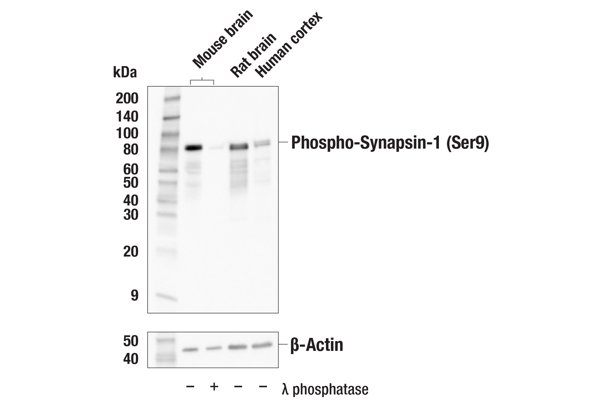 Western Blotting Image 1: Phospho-Synapsin-1 (Ser9) (E3D2X) Rabbit mAb