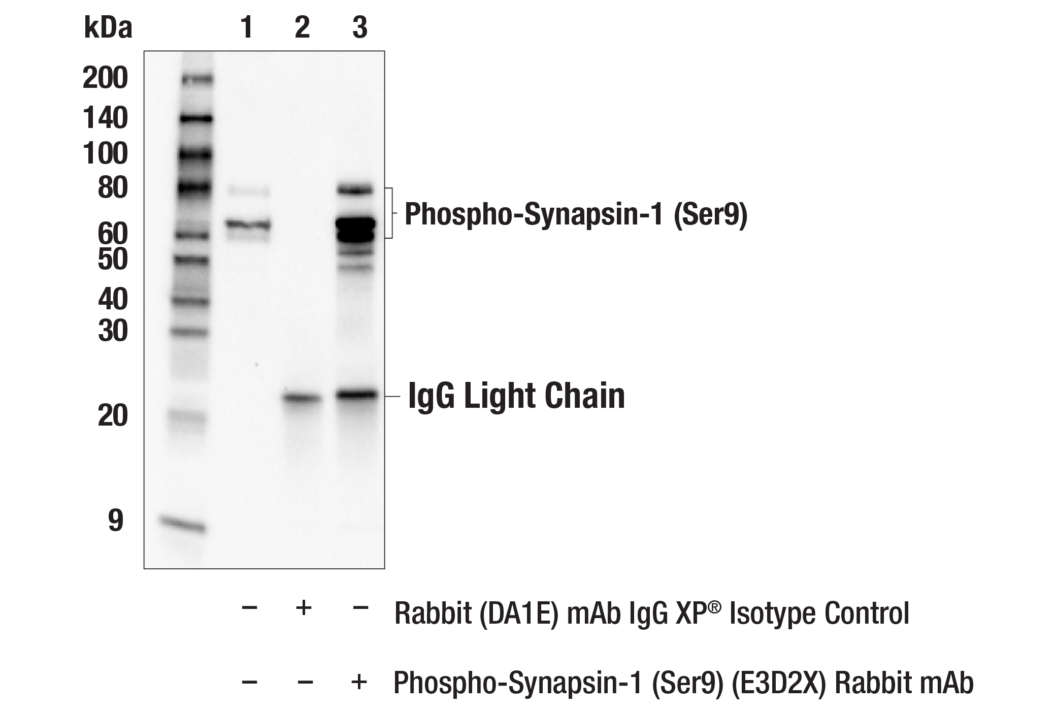 Immunoprecipitation Image 1: Phospho-Synapsin-1 (Ser9) (E3D2X) Rabbit mAb