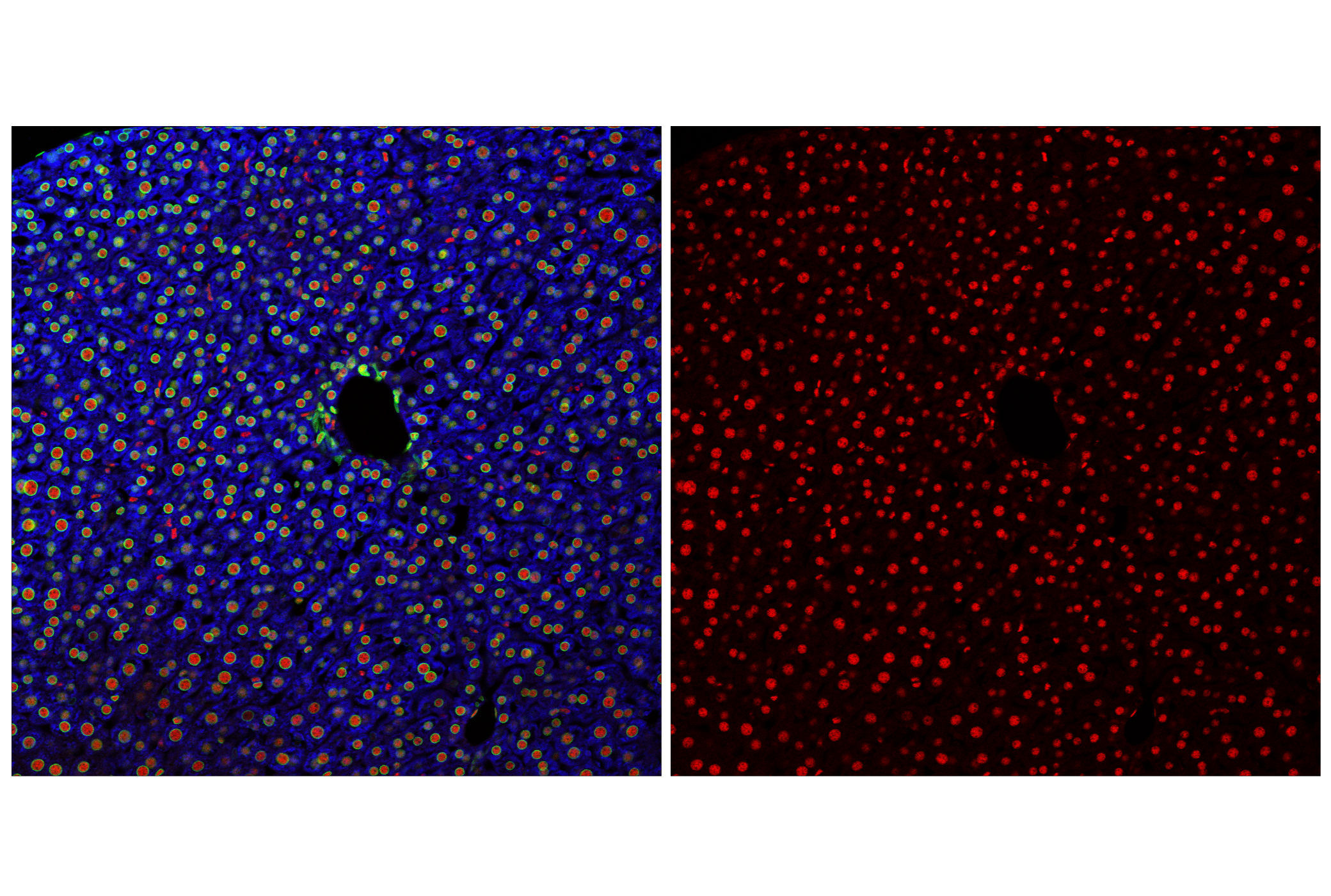 Immunofluorescence Image 1: p300 (E6D1T) Rabbit mAb