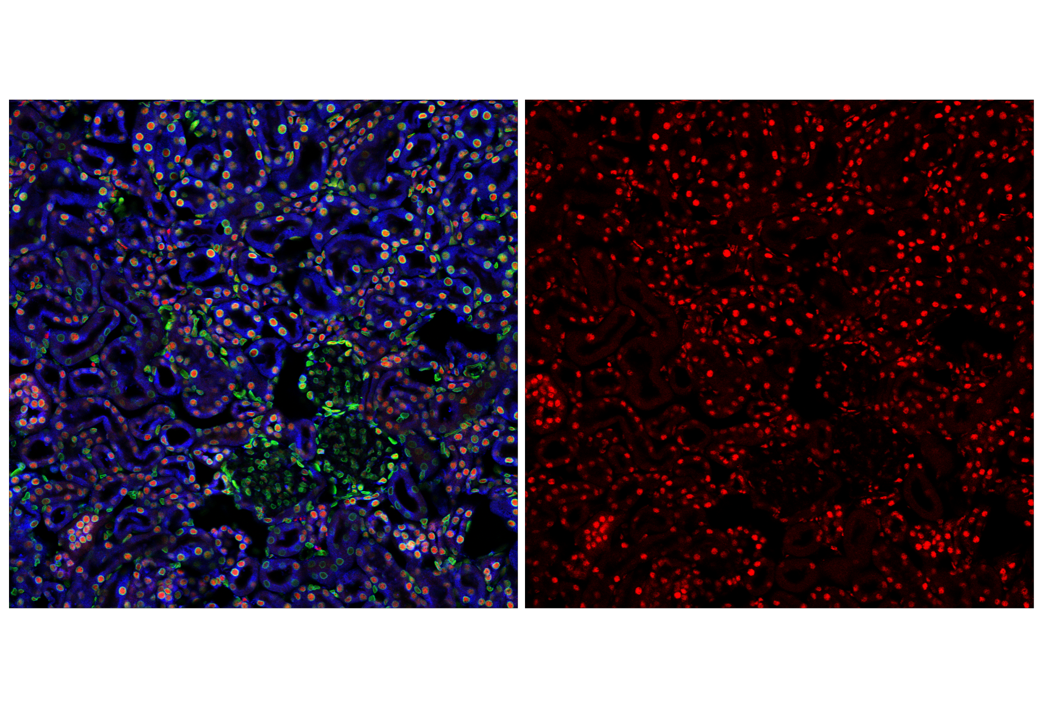 Immunofluorescence Image 2: p300 (E6D1T) Rabbit mAb