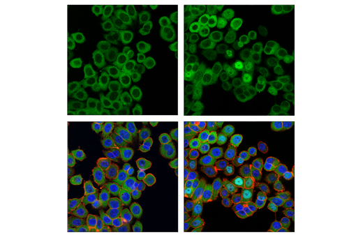 Immunofluorescence Image 1: IRF-3 (D9J5Q) Mouse mAb (Alexa Fluor® 488 Conjugate)