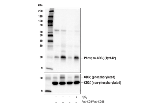Western Blotting Image 1: Phospho-CD3ζ (Tyr142) Antibody