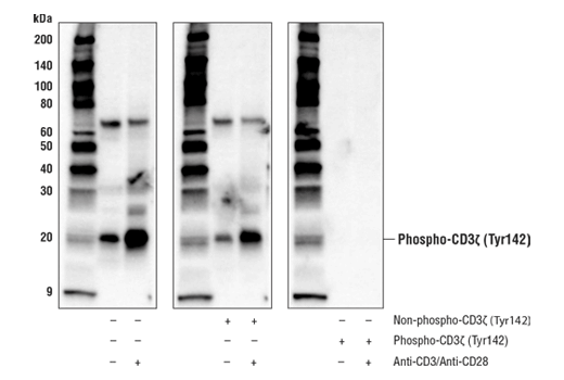 Western Blotting Image 2: Phospho-CD3ζ (Tyr142) Antibody