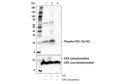 Western Blotting Image 3: Phospho-CD3ζ (Tyr142) Antibody