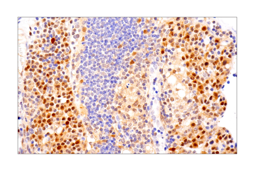  Image 33: Mouse Reactive Pyroptosis Antibody Sampler Kit