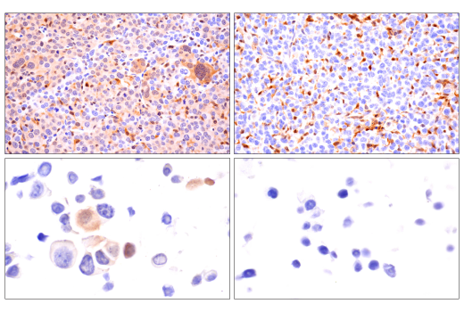  Image 56: Mouse Reactive Alzheimer's Disease Model Microglia Phenotyping IF Antibody Sampler Kit
