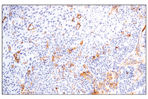 Immunohistochemistry Image 1: CD54/ICAM-1 (E3Q9N) XP® Rabbit mAb