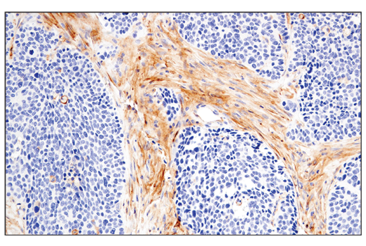 Immunohistochemistry Image 4: CD54/ICAM-1 (E3Q9N) XP® Rabbit mAb