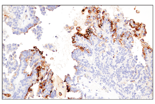 Immunohistochemistry Image 6: CD54/ICAM-1 (E3Q9N) XP® Rabbit mAb