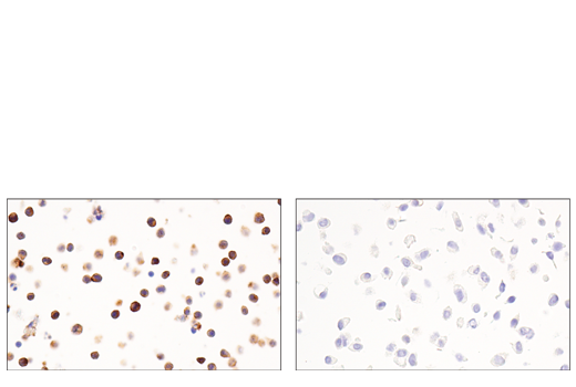 Immunohistochemistry Image 11: CD54/ICAM-1 (E3Q9N) XP® Rabbit mAb