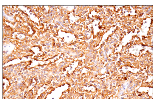 Image 28: Exosomal Marker Antibody Sampler Kit