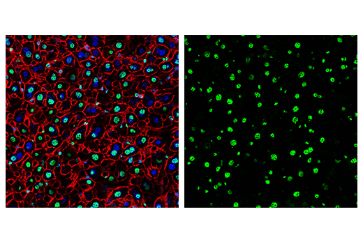 Immunofluorescence Image 2: FUS/TLS (E3O8I) Rabbit mAb
