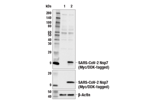 Western Blotting Image 1: SARS-CoV-2 Nsp7 Antibody