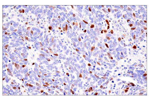 Immunohistochemistry Image 6: Cyclin A2 (E6D1J) XP® Rabbit mAb